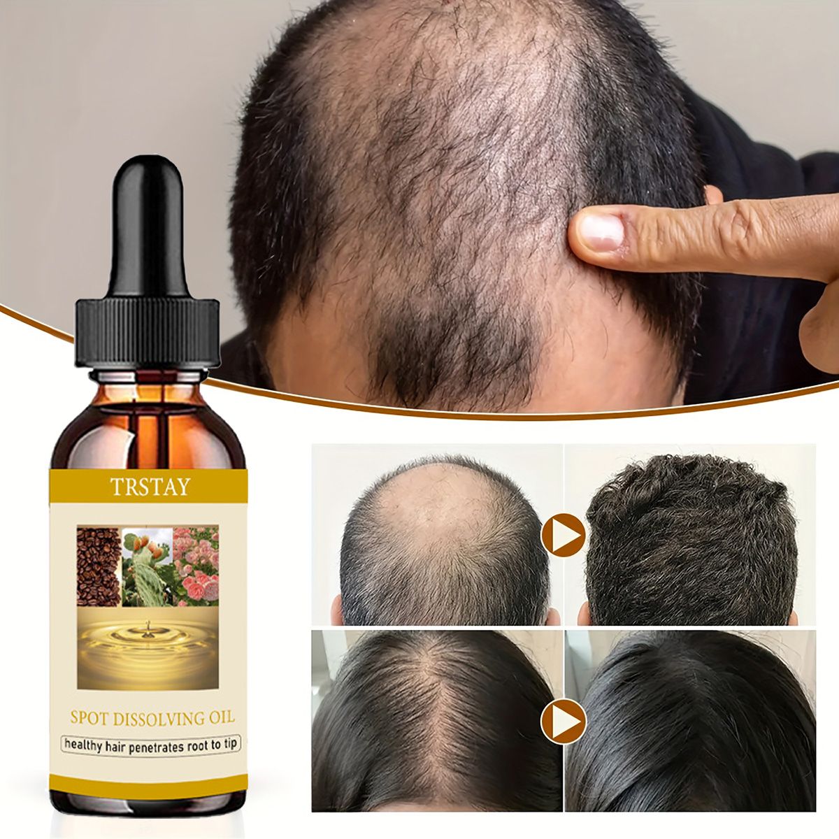 50ML Minyak Pertumbuhan Jenggo - Beard Oil ulasan dan harga